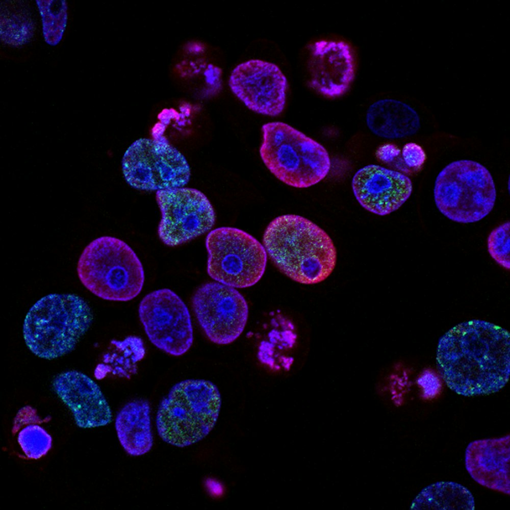 Peribiotics lab research